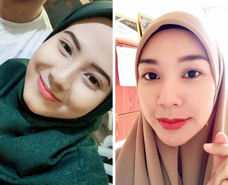 2 Wanita Cantik Ini Kongsi Petua Nak Kecutkan Jerawat 